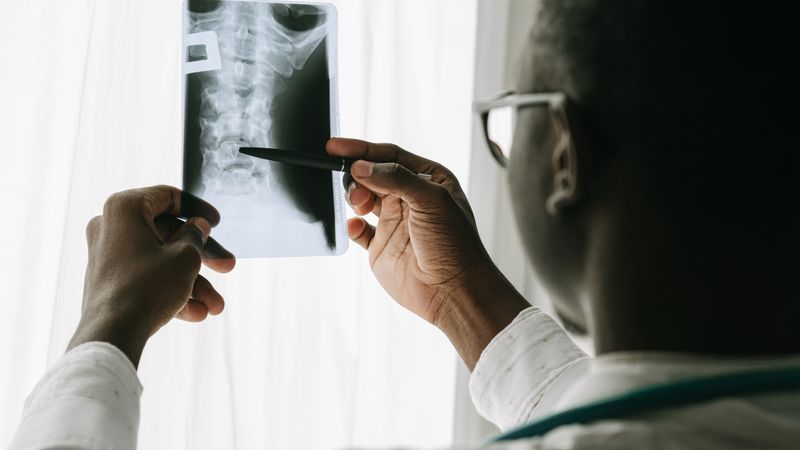 Médico analisando raio-x para laudo urgente em 30 minutos por telerradiologia